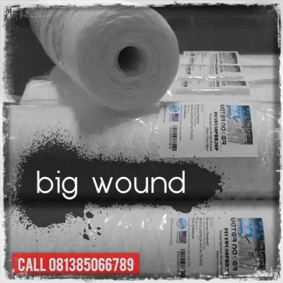 d d Big Wound Cartridge Filter Indonesia  large2